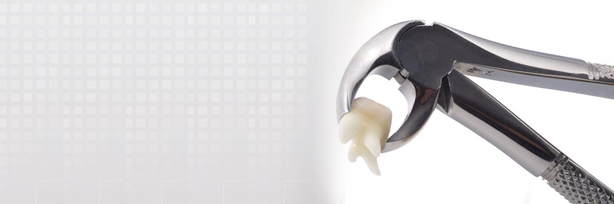 Irvine Tooth Extraction